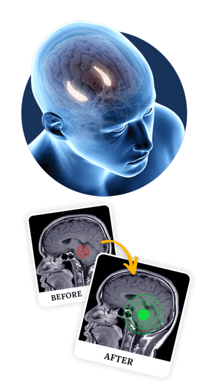 Billionaire Brain Wave